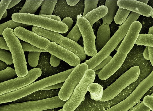 Escherichia-Coli-Koli-Bacteria-Disease-Bacteria-123081.jpg